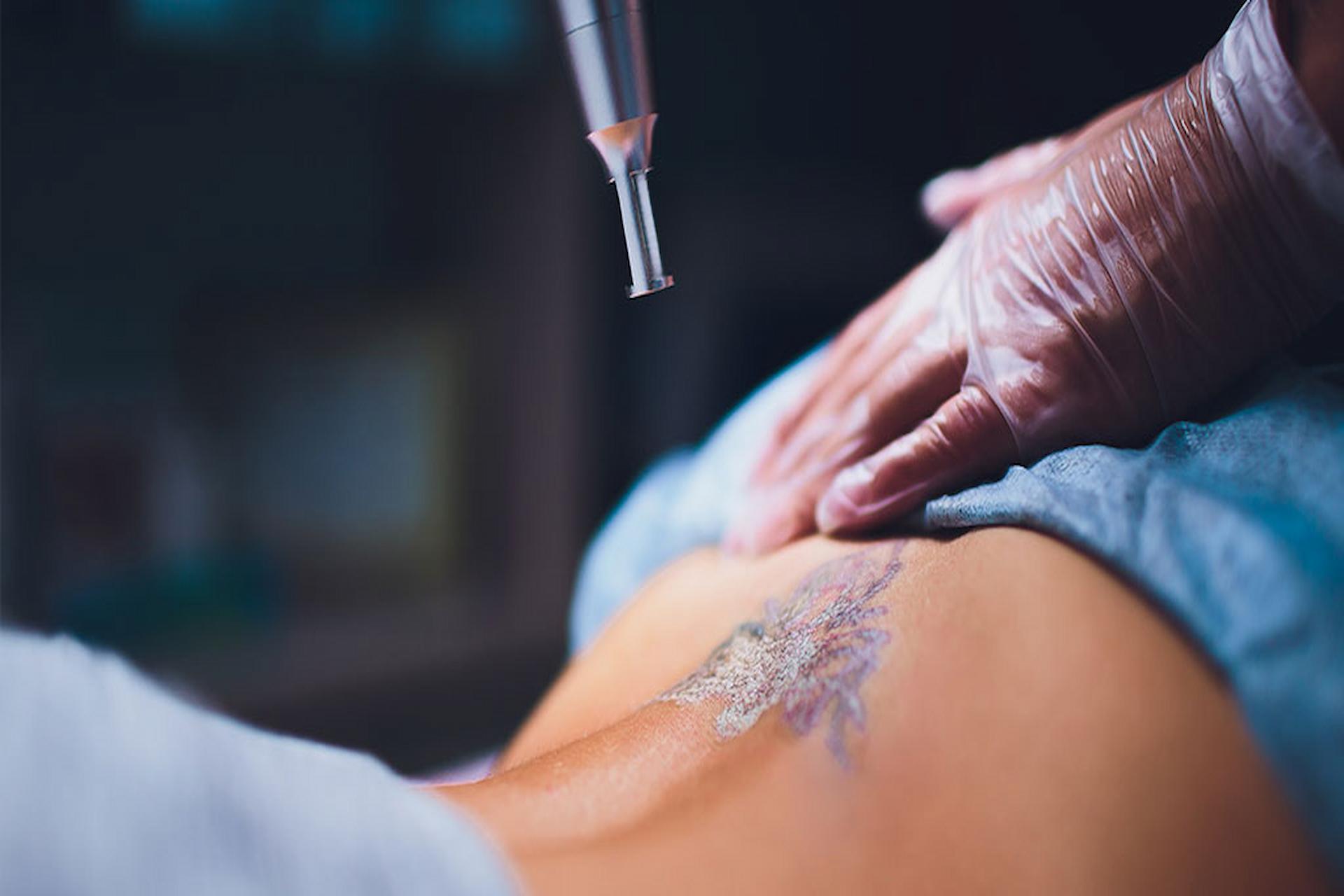 How Long Does It Take to Heal Between Sessions?